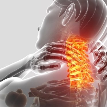 Boyun Fıtığı Egzersizle Tedavi Edilebilir Mi?