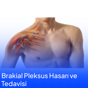 Brakial Pleksus Hasarı ve Tedavisi