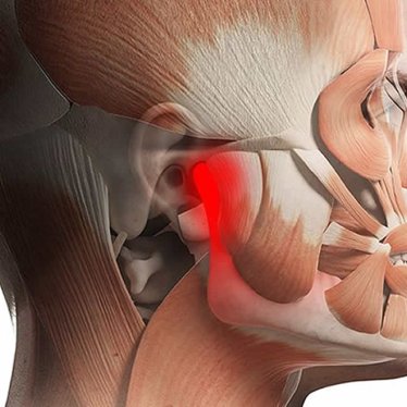 Çene Eklemi Sorunlarında Fizik Tedavi Kullanılır mı?