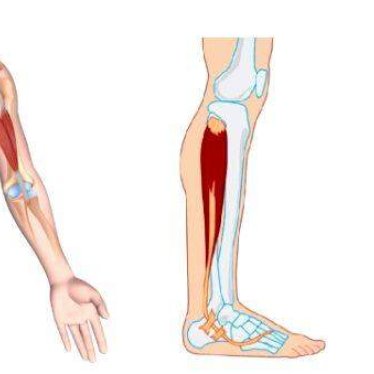 Çocuklarda DMD Hastalığında Belirtiler ve Tedavi Süreci