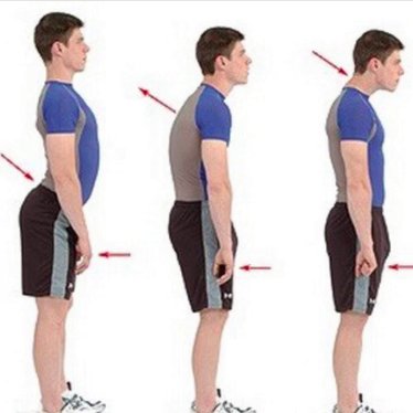 Çocuklarda Duruş Bozuklukları ve Fizik Tedavi