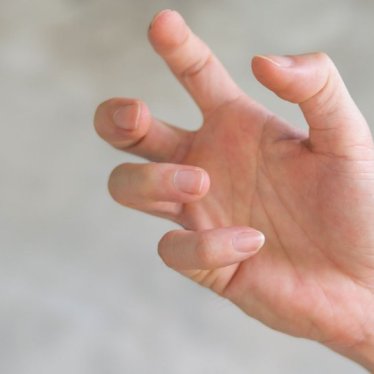 Distoni Fizik Tedavi ile Tedavi Edilebilir mi?