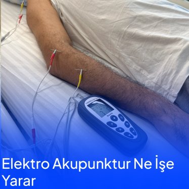 Elektroakupunktur ne işe yarar ?