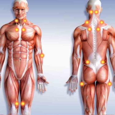 Fibromiyalji Hastalarında Fizyoterapi ile Ağrı Yönetimi