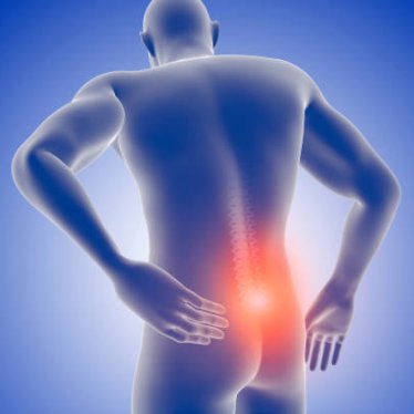 Fıtık Tedavisinde Fizik Tedavi: Ameliyatsız İyileşme Mümkün mü?