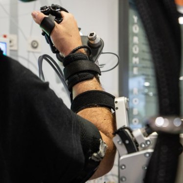 Fizik Tedavide Omuz, El Ve Kol Robotu Tedavisinin Kullanımı