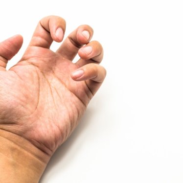 İnme Sonrası Spastisite ve Robotik Rehabilitasyonun Önemi