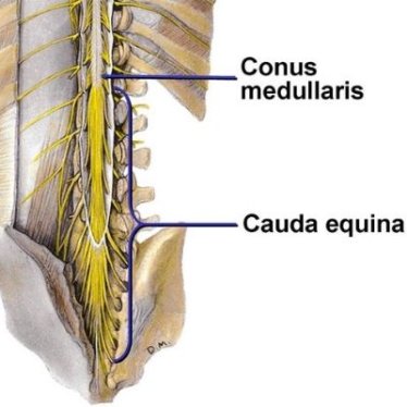 Kauda Equina Sendromu Belirtileri Nelerdir? Ne Zaman Tehlikelidir?