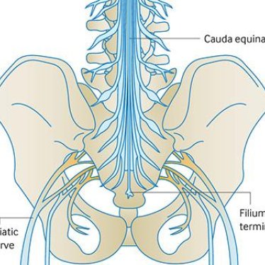 Kauda Equina Sendromu Nedir? Belirtileri, Tedavisi ve Fizik Tedavi Süreci