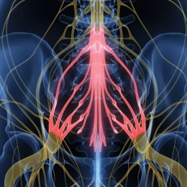 Kauda Equina Sendromu ve Tedavisi