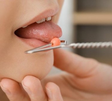 Kekemelik Tedavisi Nasıl Yapılır ?