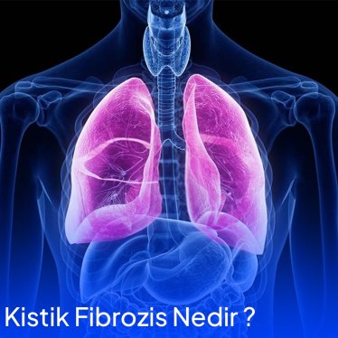 Kistik Fibrozis Nedir ?