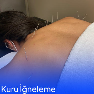 Kuru İğne Tedavi̇si̇ Nedi̇r ?