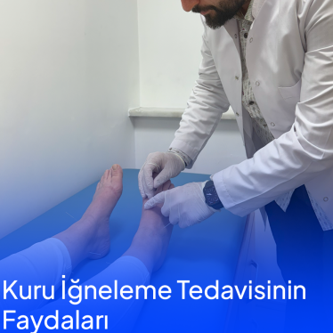 Kuru İğneleme Tedavisinin Faydaları Nelerdir ?