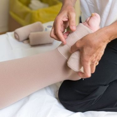 Lenfödem Tedavisinde Güncel Yöntemler ve Fizyoterapinin Rolü