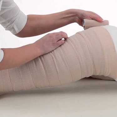 Lenfödem Tedavisinde Yatılı Fizik Tedavinin Önemi