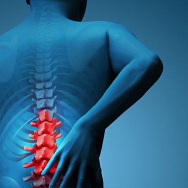 Lumbal Disk Hernisinde (Bel Fıtığı) Robotik Destekli Rehabilitasyon