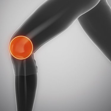 Menisküs Yırtıkları Her Zaman Ameliyat Gerektirir mi?