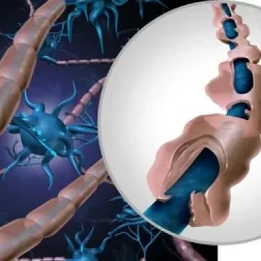 MS ve En Sık Sorulan 10 Soru