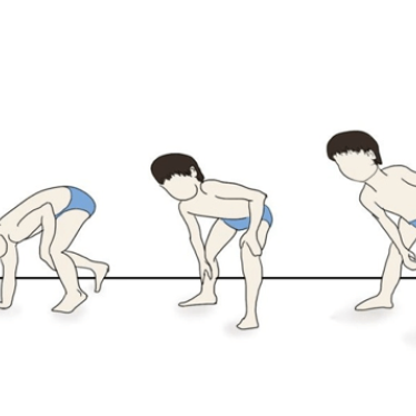 Musküler Distrofi Nedir? Tedavi Edilebilir mi?