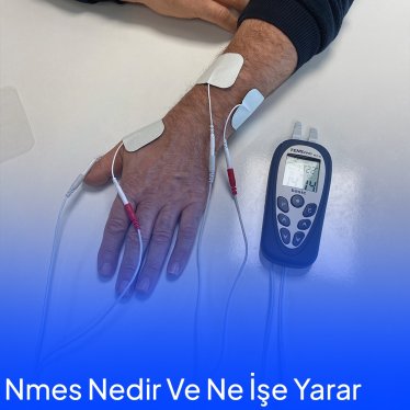 Nmes Tedavisinin Kas Gelişiminde Yeri