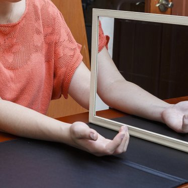 Nörolojik Rehabilitasyonda Ayna Terapisinin Motor İyileşme Üzerindeki Rolü ve Etkililiği