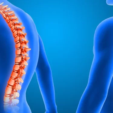 Omurga Deformitelerinde Fizik Tedavi