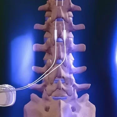 Omurilik Pili nedir ve ne işe yarar ?