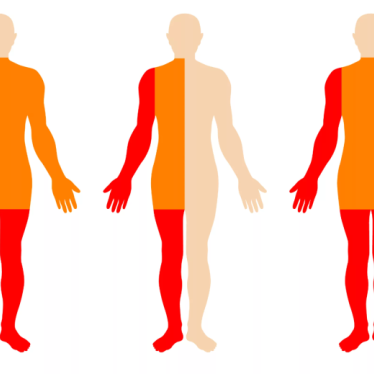 Omurilik Pili ve Parapleji’de Kullanımı