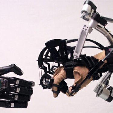 Omuz, El ve Kol Robotu ve Ergoterapi