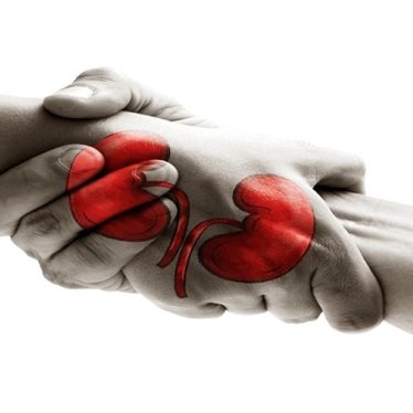 Organ Nakli Sonrasında Fizik Tedavi Süreci Gerekir mi?