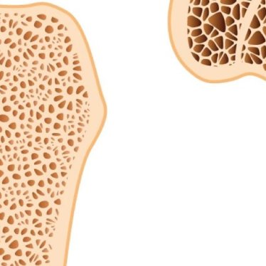 Osteoporozda Egzersiz Yaklaşımları ve Düşme Riskinin Azaltılması