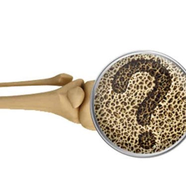 Osteoporozda Egzersiz Yaklaşımları ve Düşme Riskinin Azaltılması