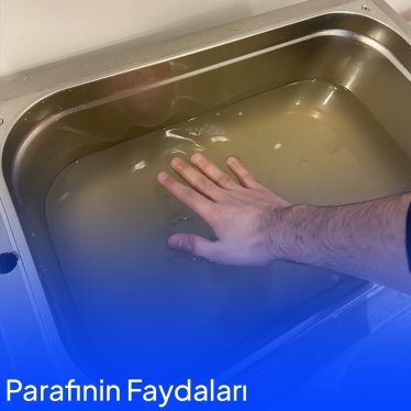Parafin Uygulamalarının Fizik Tedavideki Faydaları