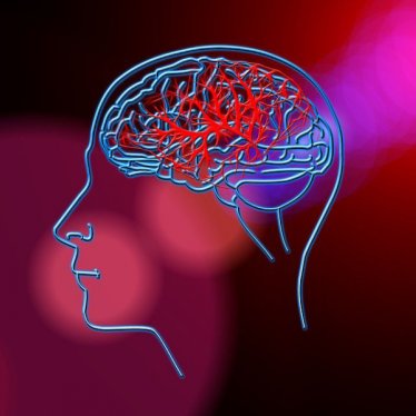 Parapleji ve Robotik Rehabilitasyon