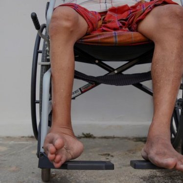 Poliomyelit Sekeli ve Robotik Rehabilitasyon