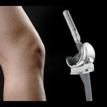 Protez Ameliyatı Sonrası Tekrar Yürüme