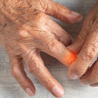 Romatizma Ağrılarında Fizik Tedavi