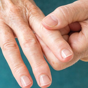 Romatolojik Hastalarda Fizik Tedavinin Faydaları