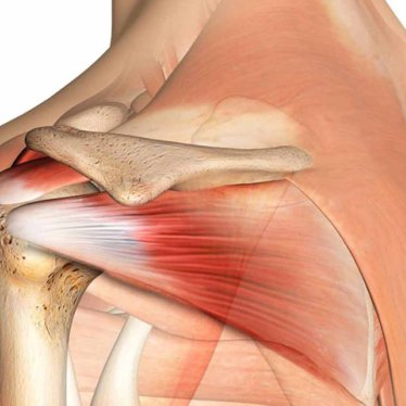 Rotator Manşet Yırtıkları: Fizyoterapi ve Rehabilitasyonun Rolü