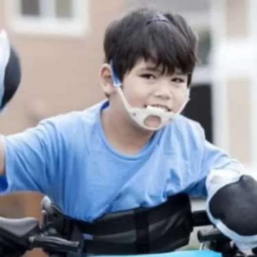 Serebral Palsi Olan Çocuklarda Modern Rehabilitasyon