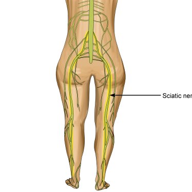 Siyatik Sinir Ağrısına Fizik Tedavi İyi Gelir mi?