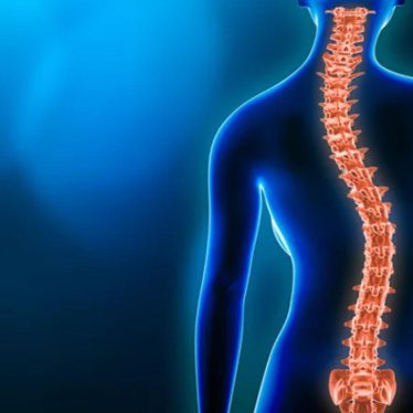 Skolyozda Korse mi Egzersiz mi? Doğru Tedavi Yaklaşımı Nasıl Belirlenir?