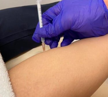 Spasti̇si̇tede Botox Enjeksi̇yonu