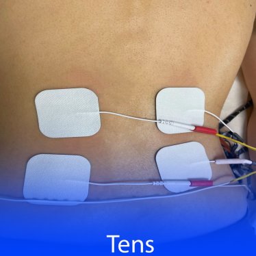 Tens (Transkutanöz Elektriksel Sinir Stimülasyonu) Nedir ?