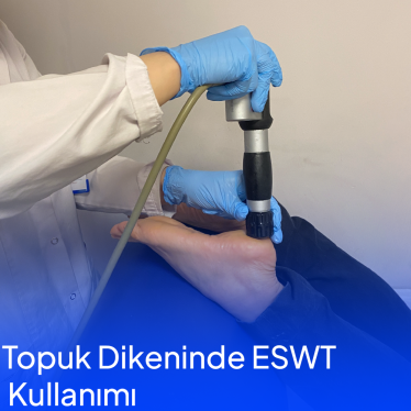 Topuk Dikeninde ESWT Nedir ?