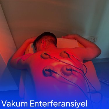 Vakum Enterferansiyel Akım ve Fizik Tedavi
