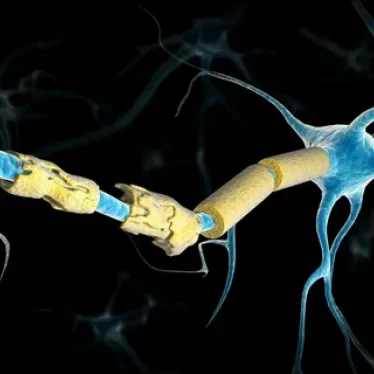 Yaşlılarda Multiple Skleroz Riski ve Robotik Rehabilitasyonun Önemi