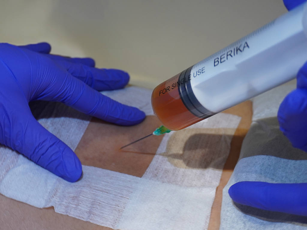 Stem Cell Treatments