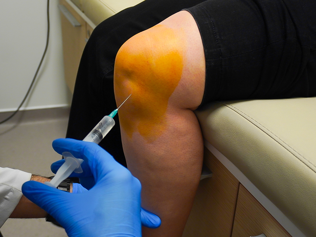 PRP (Healing from your own blood)